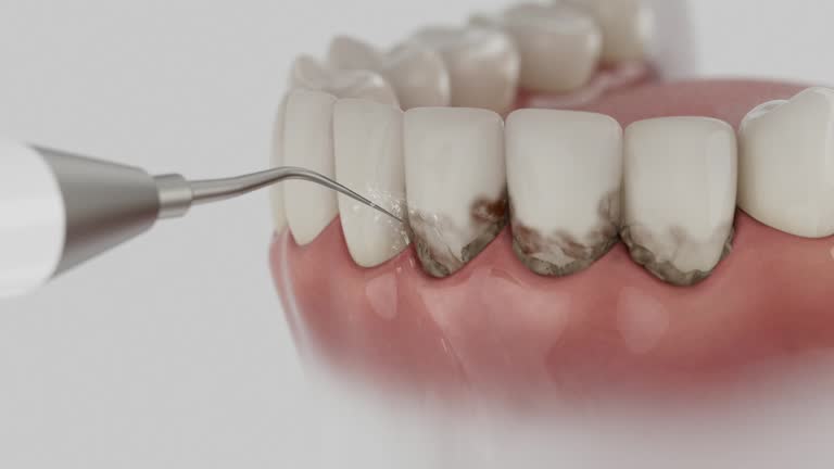 Trusted Wisdom Tooth Removal service in Blytheville, AR - Dentist Open Now